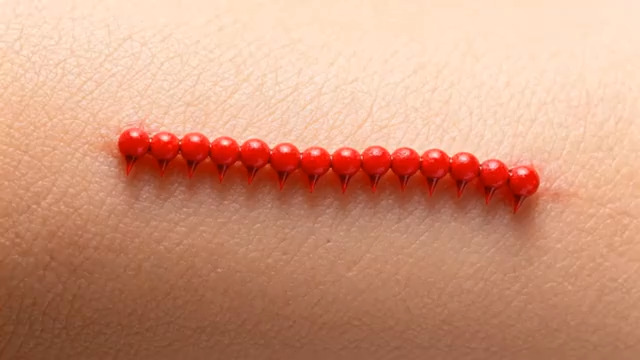  皮肤上的红色珠子排列1697#横屏 	 