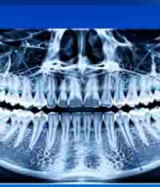  牙科光片牙齿骨骼影像2131#横屏 	 