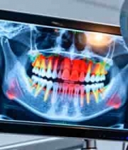  牙科光影像显示牙齿状况2594#横屏 	 