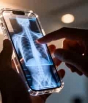  手持手机查看骨骼影像素材2789#横屏 	 