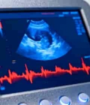  医疗超声设备屏幕画面2800#横屏 	 