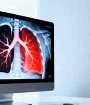  电脑屏幕展示人体肺部结构2897#横屏 	 - 