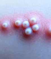  珍珠美容皮肤特写3140#横屏 	 