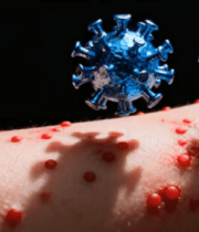 病毒与皮肤感染动画80#横屏 